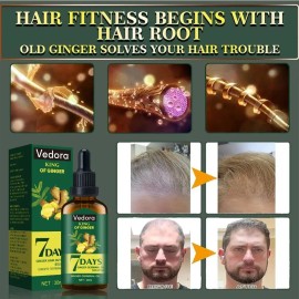 Vedora King Of Ginger Oil For Hair Growth - Biotin Hair Grow