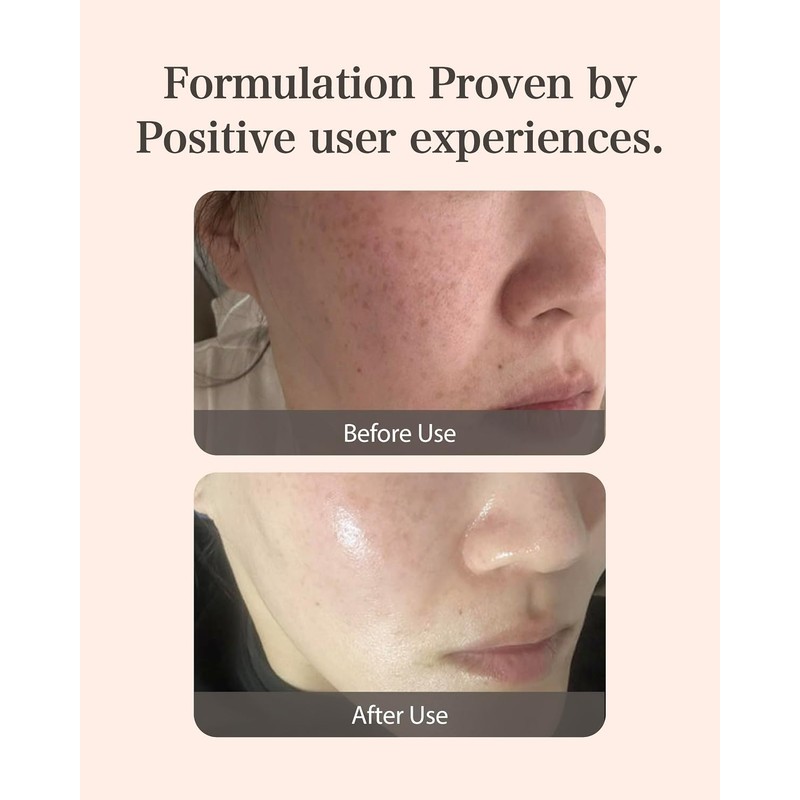 Mastic 6-Hours Ampolla Serum Spoid Type Mastic 6-Hours Ampolla (Dropper