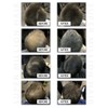 Super Million Hair - 1 x 25g Hair Building Fibres