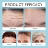 60 PCS Forehead Wrinkle Patches,Forehead Anti Wrinkles Patches,F/orehead P/atches for