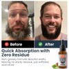 Beard Oil and Leave in Conditioner Softener, Promotes Healthy Beard