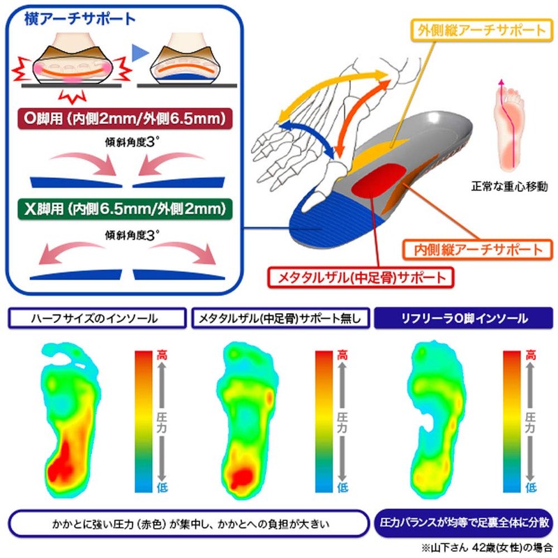 Refreer O-Leg Correction Insole, Crotch, Insole, Footplate, 10.8-11.0 inches (27.5-28.0