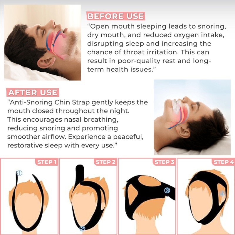 Massner Extra Strength Chin Strap for Sleeping, Breathable, Comfortable CPAP