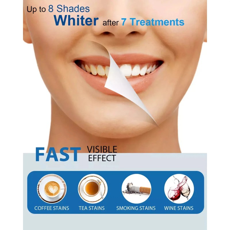 MySmile 2Pack Pro Teeth Whitening Kit with 28-LED Light Tray