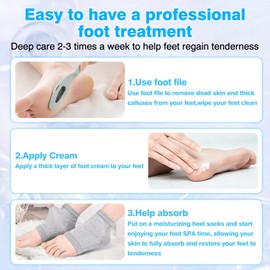 Yunmeng Urea Cream 40 Percent for Feet Maximum Strength, with Moisturizing Heel Socks for Cracked Heel Repair,Foot Cream for Dry Cracked Heels and Feet,Urea Lotion, 3.5 OZ, Foot Files