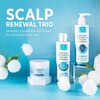 Roycederm Champú para la psoriasis, dermatitis seborreica, foliculitis y caspa,