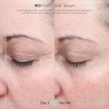 Isispharma Glyco-a Soft Peeling 30ml