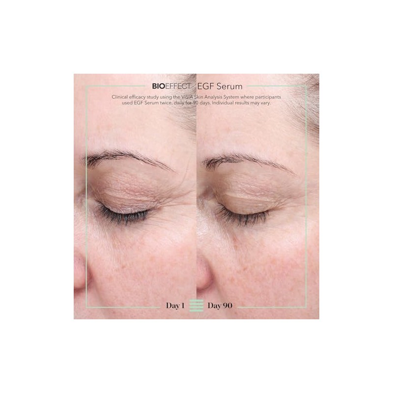 Isispharma Glyco-a Soft Peeling 30ml