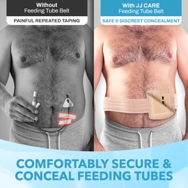 JJ CARE Feeding Tube Belt (Small), Breathable PEG Tube Belt, Nylon Fabric Gtube Belt Compatible with PEG Tubes and Gastrostomy Tubes, Adjustable and Washable G Tube Holder