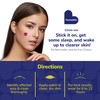 BioSwiss Psychedelic Pimple Patches, Hydrocolloid Acne Patch for Zits and