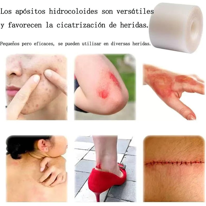 Hydrocolloid Bandage Roll, Waterproof Cut-to-Size Medical Grade Hydrocolloid Roll (2