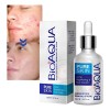 Serum Skin Care Elimina Acné Granos Espinillas Piel Facial F