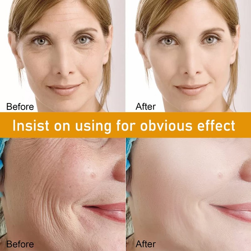 Soluble protein thread, nano gold essence combination, combination of soluble