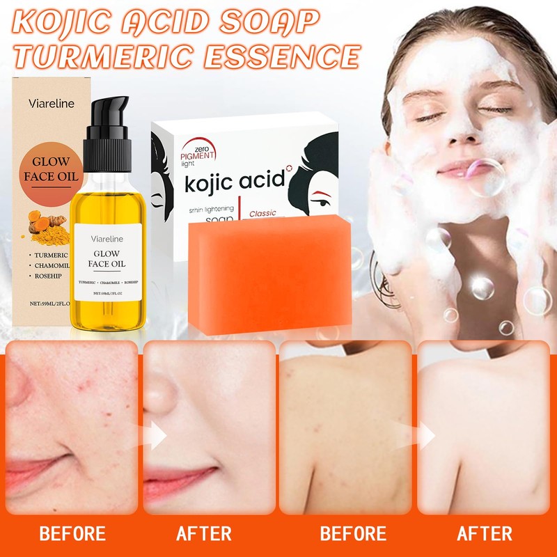 Soap, Dark Spot Removal and Blackheads (Turmeric D)