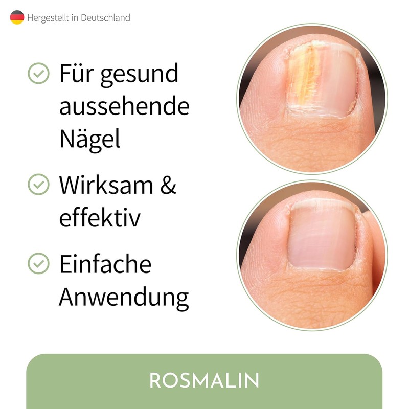 Nail Care Pen – Particularly Effective – From Germany –