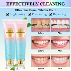 2 Pcs Easilyous White Toothpaste, Niacinamides Intensive Whitening Toothpastes, Niacinamide White Toothpastes, Fresh Breath, Remove Tooth Stains