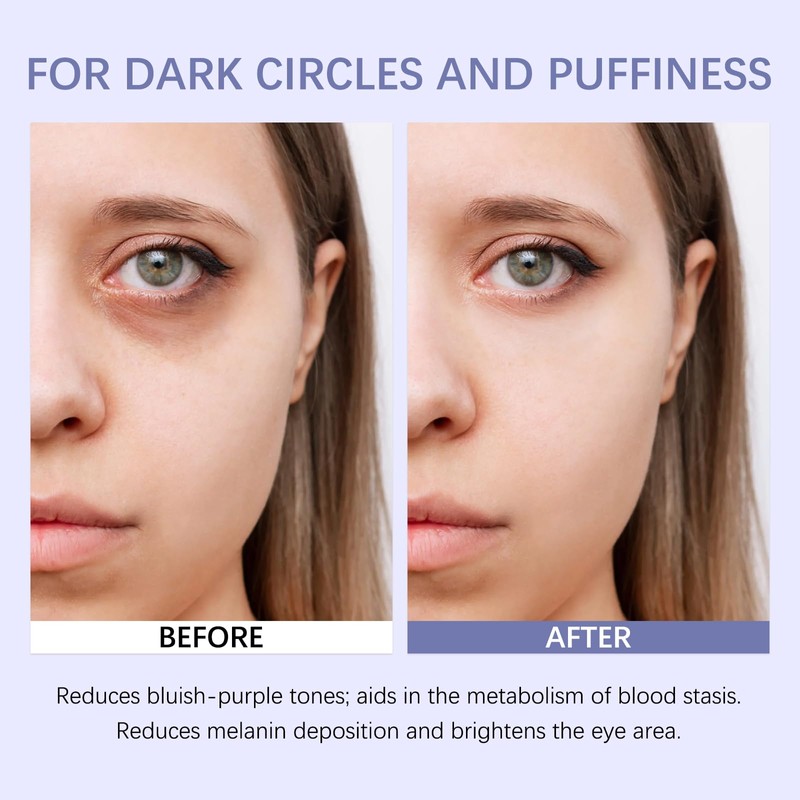 Retinol & Caffeine Eye Balm Stick for Dark Circles, Puffiness,