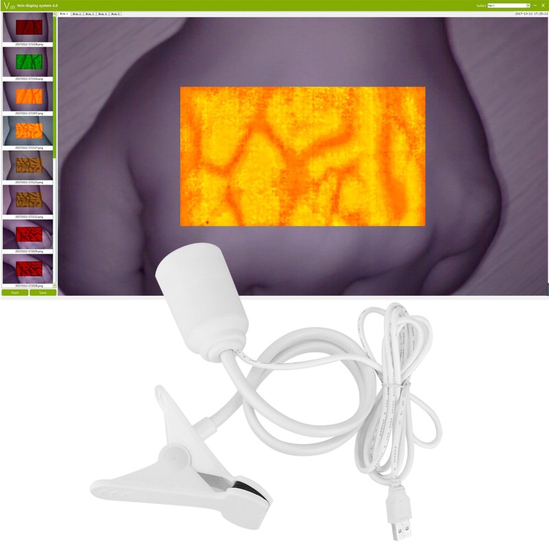 Vein Finder Vein Lights Imaging Viewer Display Machine for Adult