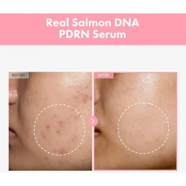 Pdrn Serum Facial Pink Peptide12 - Tosowoong. 33ml Momento De Aplicación Noche Tipo De Piel Todo Tipo De Piel