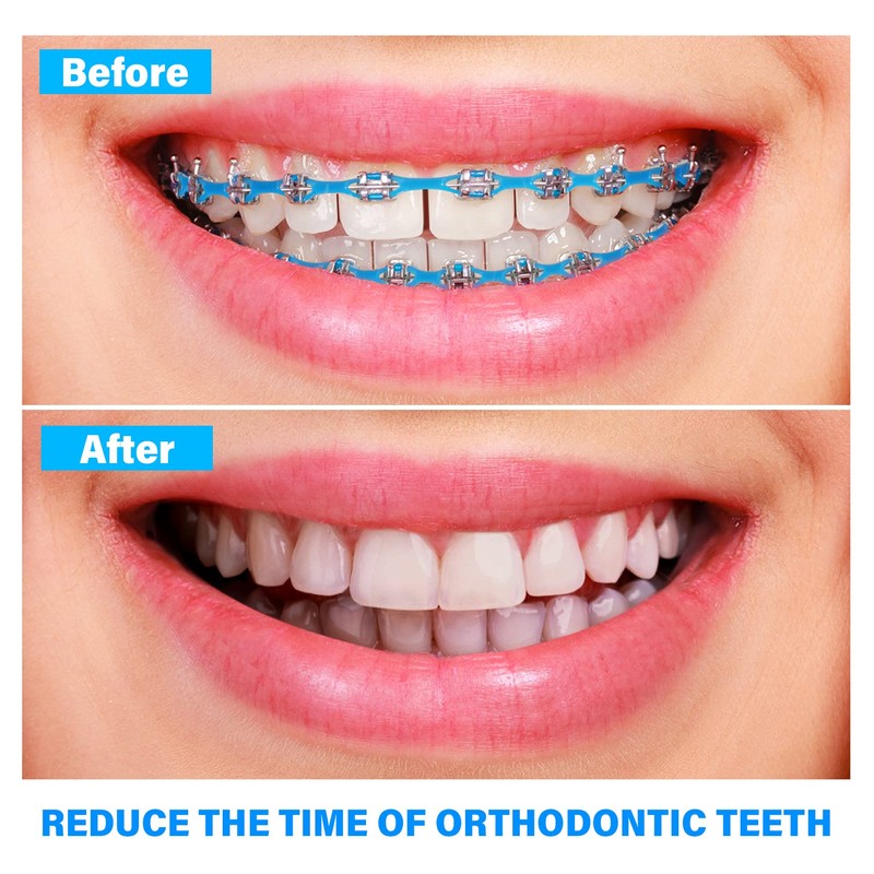 Orthodontic Spool Elastic Dental Spool Elastic Rubber Band Power Chains