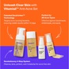 Dermz Acne Treatment - Acne Cream, SPF Face Protection, Face