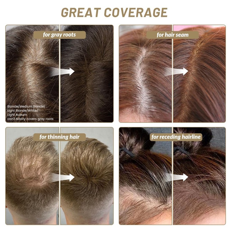 SOVONCARE Instantly Hairline Powder, Hairline Shadow Gray Coverage for Thinning