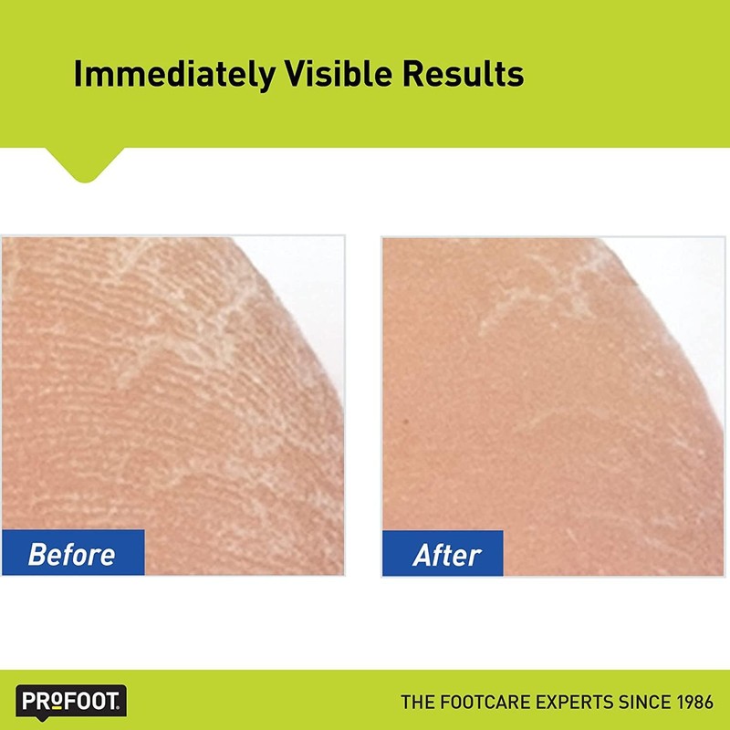 ProFoot Heel Rescue Superior Moisturizing Foot Cream 16 oz (Pack