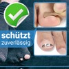 Kosmetex 3x Zehenbinde 1.5cm selbsthaftende Binden, Zehen Verband, fixieren, elastisch,