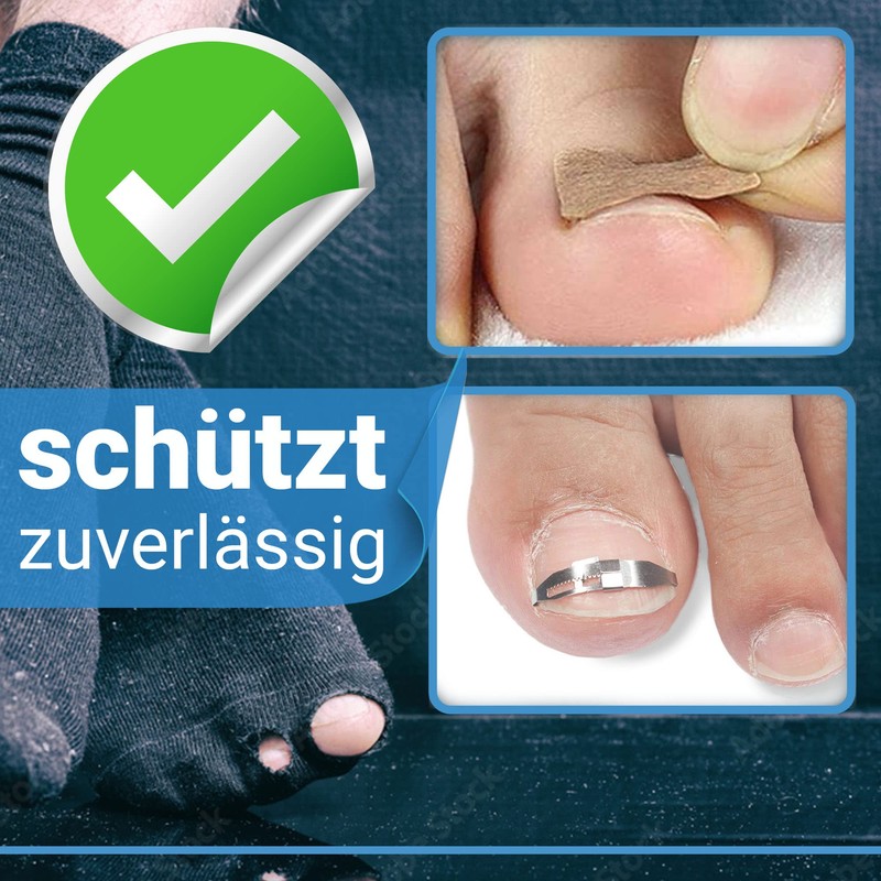 Kosmetex 3x Zehenbinde 1.5cm selbsthaftende Binden, Zehen Verband, fixieren, elastisch,