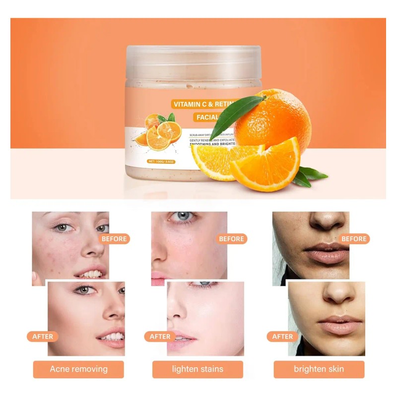 Exfoliante Facial De Vitamina C Y Retinol, Exfoliante Facial