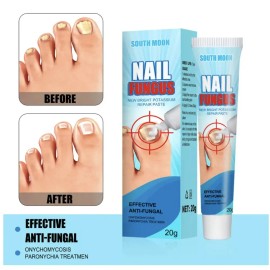 Tt/ Crema Fungicida Para Hongos En Uñas Y Piel De Manos O