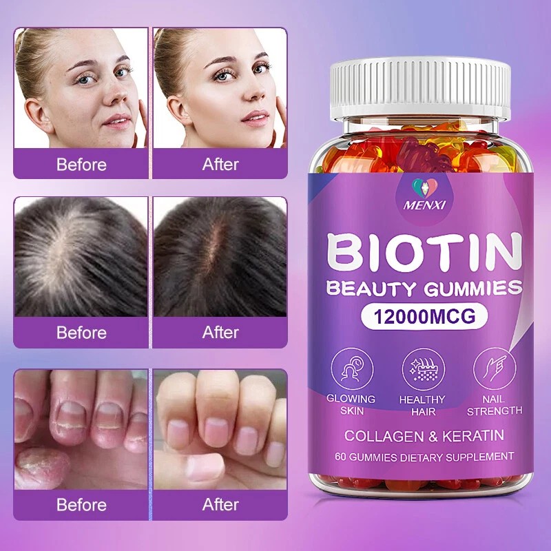 Biotin Collagen Gummies 12000Mcg - Maximum Potency for Hair, Skin,