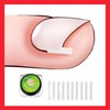 Ingrown Toenail Corrector & Nail Tip Care Tool Self-Use 6ea