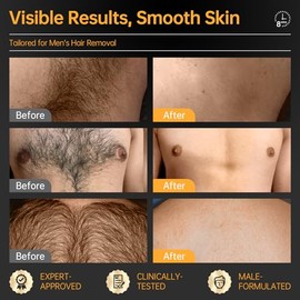 CKM Crema Depilatoria Para Hombres, Crema Depilatoria Para El Vello Masculino No Deseado, Gel Depilatorio Indoloro Apto Para Todo Tipo De Piel, Formulado Para Hombres, 6.76 Onzas Líquidas Con Espátula