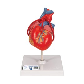 3B Scientific 1017837 Human Anatomy - Classic Heart Model with Bypass, 2 Part + free Anatomy App - 3B Smart Anatomy