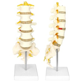 QWORK Life-Size Human Spine Model with 5 Lumbar Vertebrae and Herniation Discs - Ideal for Medical Teaching and Scientific Classroom