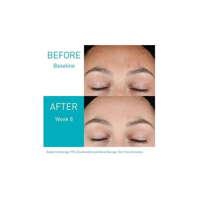 Crea CeraVe Resurfacing Retinol Serum Para Marcas De Acné 3
