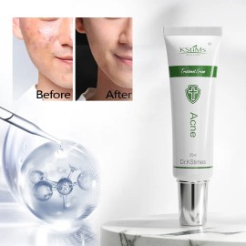 Crema Eliminadora De Espinillas Coreana Para El Cuidado De L