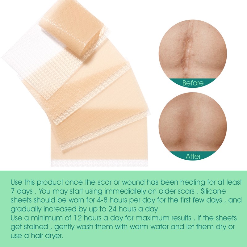 4 Pcs Elaimei Silicone Scar Sheets Stretch Marks Remover Post
