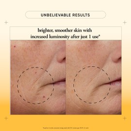 philosophy microdelivery vitamin c resurfacing peel kit - with lactic acid & sunflower seed oil - two-step treatment to smooth rough texture, even skin tone and minimize the appearance of fine lines