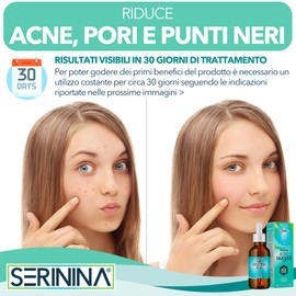 Salicylic Acid Serum Face - 2% BHA Peeling Salicylic Acid - Pimple Remover - Face Serum Anti Pimples, Anti Blackheads, Reduces Pores - Blemished Skin Face - 30 ml