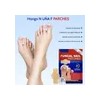 ~ Parches Para Uñas Fc Fungal, 63 Unidades/caja De Parche