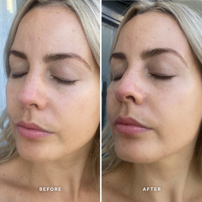 Alpha-H Vitamin E Serum with 1% Ceramide Complex 10ml