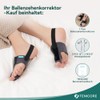 TENICORE Hallux Valgus Correction with 2 Angle Irons Toe Separator