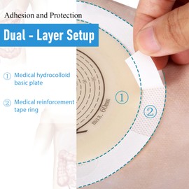 Colostomy Bags, Ostomy Supplies, One - Piece Ostomy Drainable Pouches for Ileostomy Stoma Care, Hook & Loop Closure, 10 PCS, A Customizable Cut - to - Fit Baseplate(15-60mm)