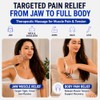 Melonsun - Herramienta de masaje de punto gatillo para alivio