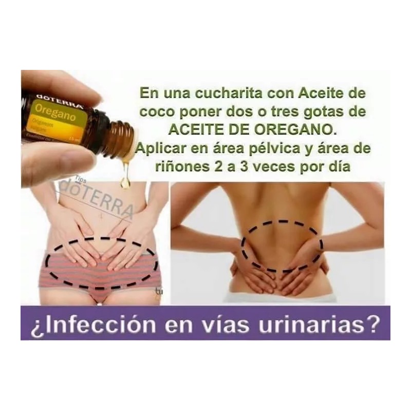 Doterra Aceite Esencial Oregano Doterra 15ml Antibacteriano + Regalo