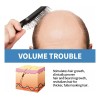 Sérum Re:act Minoxi Roll-on Para El Crecimiento Del Cabello,