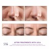 Spa Sciences - LELA - 4-in-1 Facial Spatula for Deep