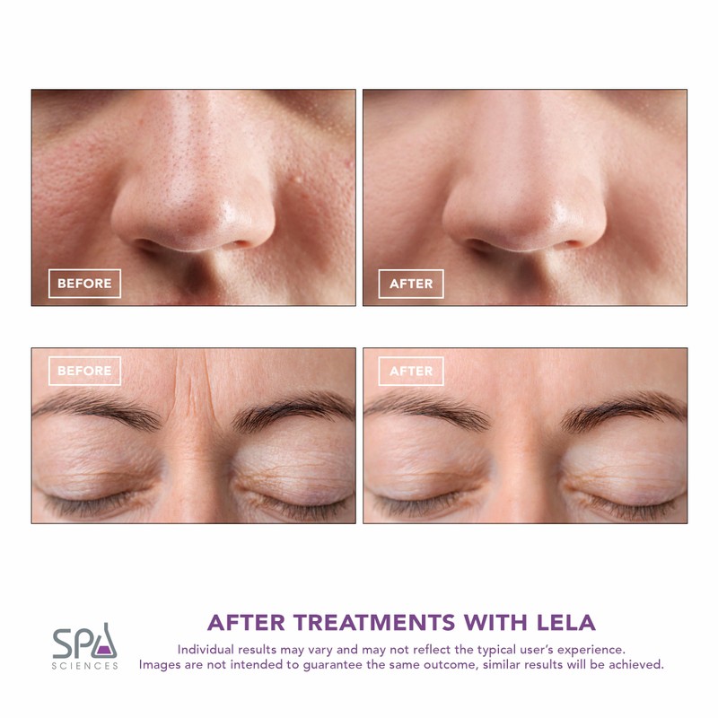 Spa Sciences - LELA - 4-in-1 Facial Spatula for Deep
